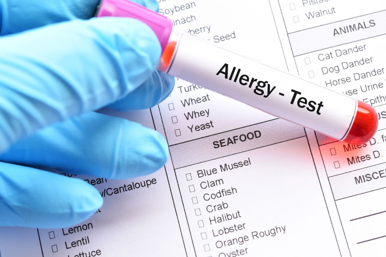 Test allergie